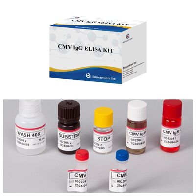 کیت آزمایش 96T CMV ELISA با تشخیص رنگ سنجی و روش ساندویچ برای آنتی بادی های سیتومگالوویروس