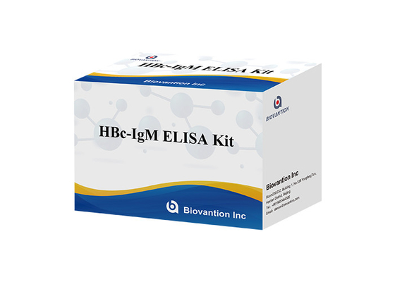 کیت تست IgM HBc ISO13485 تست Igm آنتی بادی هسته هپاتیت B