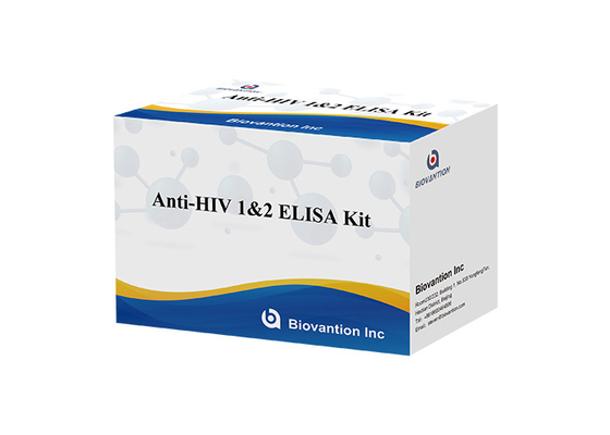 برای آزمایشگاه یا بیمارستان کیت تست ضد HIV1/2 Elisa با دقت بالا