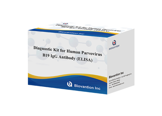 کیت تشخیصی برای پاروویروس B19 IgG ELISA کیت آزمایش آنتی بادی برای نمونه های سرم
