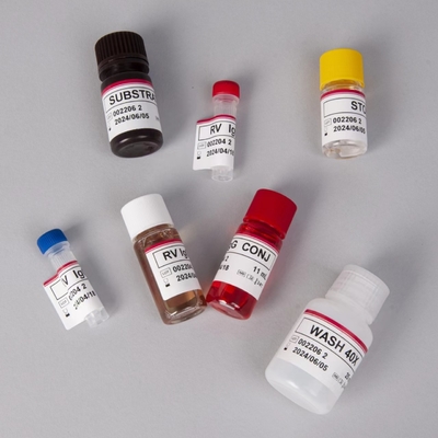 کیت آزمایش RV-G Elisa برای تشخیص نوع نمونه پلاسما