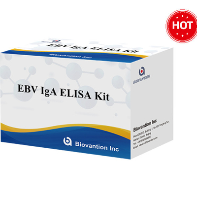 EBV-VCA IgA Ab ELISA Kit Kit Kit Kit Kit Kit Kit Kit Kit Kit Kit Kit Kit Kit Kit Kit Kit Kit Kit Kit Kit Kit Kit Kit Kit Kit Kit Kit Kit Kit Kit Kit Kit Kit Kit Kit Kit Kit Kit Kit Kit Kit Kit Kit Kit Kit Kit Kit Kit Kit Kit Kit Kit Kit Kit Kit Kit Kit Kit Kit Kit Kit Kit Kit Kit Kit Kit Kit Kit Kit Kit Kit Kit Kit Kit Kit Kit Kit Kit Kit Kit Kit Kit Kit Kit Kit Kit Kit Kit Kit Kit Kit Kit Kit Kit Kit Kit Kit Kit Kit Kit Kit Kit Kit Kit Kit Kit Kit Kit Kit Kit Kit Kit Kit Kit Kit Kit Kit Kit Kit