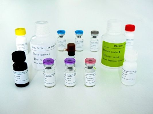 سیروم پلاسمای TB-IGRA