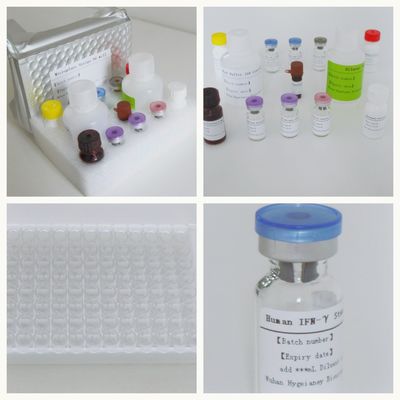 سیروم پلاسمای TB-IGRA