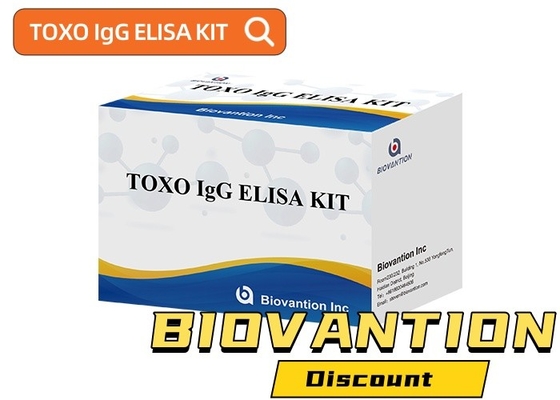 کیت تست حساس و خاص الیزای TOXO Ig G برای نظارت بر بیماری
