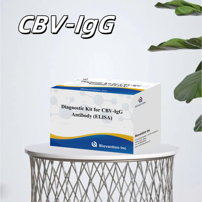 کیت تشخیصی حساسیت برای تشخیص آنتی بادی CBV-IgG انسان کیت الیزای برای تشخیص دقیق نوع نمونه