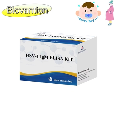 کیت آزمایش ELISA مشعل HSV 1 IgM High Hot Sale Reagent تشخیصی IVD