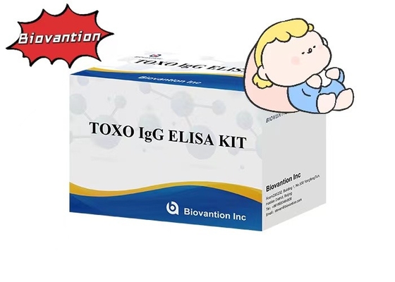 کیت آزمایش TOXO IgG ELISA با حساسیت بالا