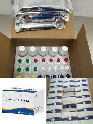 زمان انتقال آنتی بادی های ضد HCV به ویروس هپاتیت C به واسطه آنزیم کوتاه