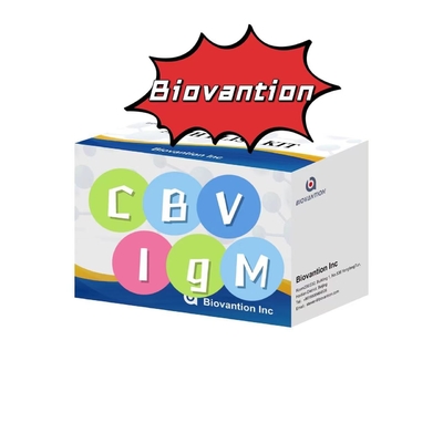 کیت تشخیصی برای آنتی بادی IgM به CBV کیت تست الیزا 50μL سرم تشخیص پزشکی