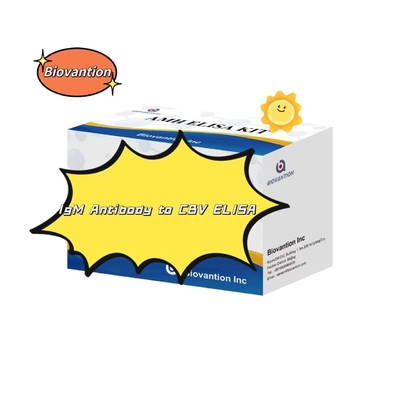 کیت تشخیصی برای آنتی بادی IgM به CBV کیت تست الیزا 50μL سرم تشخیص پزشکی