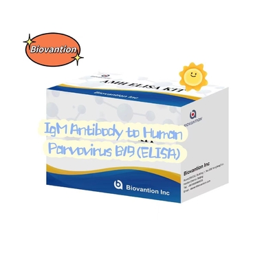 آنتی بادی به پارووویروس انسانی B19 IgM کیت آزمایش ELISA کیت تشخیصی