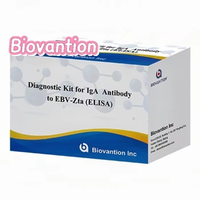 کیت تشخیصی برای IgA آنتی بادی به EBV-Zta ELISA KIT Immunosorbent Assay Test Kit