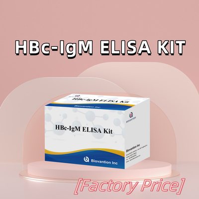 آزمایش واکنش دهنده تشخیصی HBc IgM با دقت بالا با کیت آزمایش ایمونوسوربانت مرتبط با آنزیم