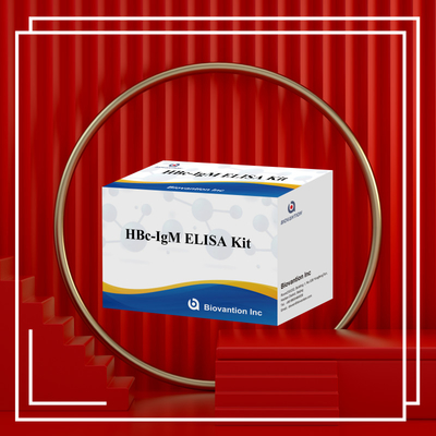 آزمایش واکنش دهنده تشخیصی HBc IgM با دقت بالا با کیت آزمایش ایمونوسوربانت مرتبط با آنزیم