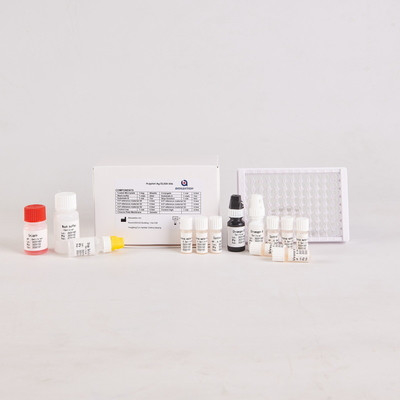 برای آزمایشگاه یا بیمارستان کیت آزمایش H.Pylori IgG Elisa با دقت بالا