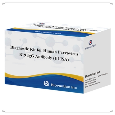 فروش مستقیم کارخانه کیت B19 ELISA برای انسان کیت آزمایش آنتی بادی IgM Elisa با 96T