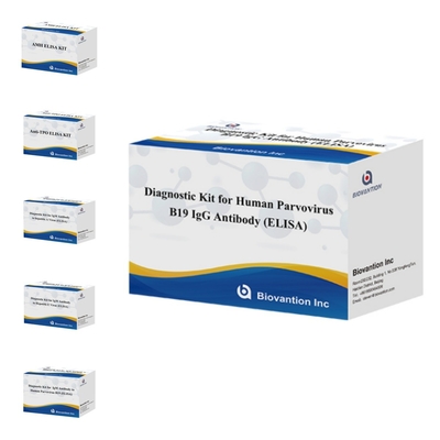 فروش مستقیم کارخانه کیت B19 ELISA برای انسان کیت آزمایش آنتی بادی IgM Elisa با 96T