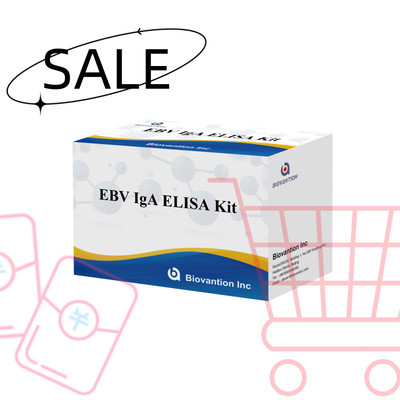 کیت آزمایش EBV HUMAN ELISA 2-8°C حساسیت کیت تشخیصی برای IgA آنتی بادی به EBV-EA