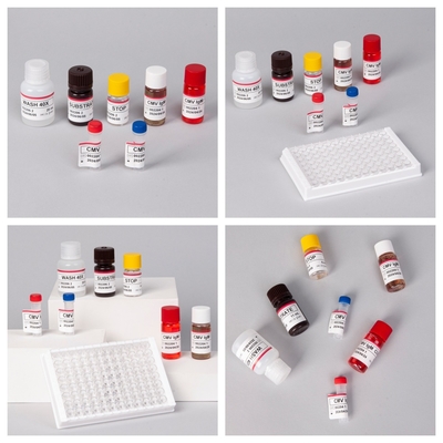 آزمایشات آنتی بادی های Cytomegalovirus CMV
