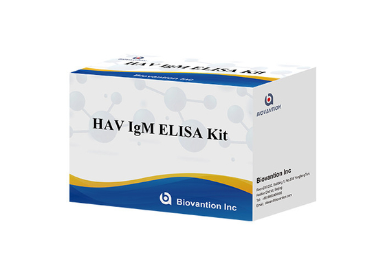 آنتی بادی ها به هپاتیت A HAV IgM In Vitro Enzyme Immunoassay سرم / پلاسم