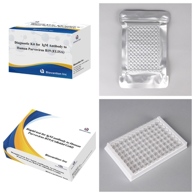 کیت تشخیصی برای پادتن های IgM بروویروس B19 انسان ELISA ایده آل برای عفونت های ارئتما و عوارض در بارداری