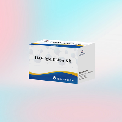 HAV IgM ELISA Kit حساسیت بالا هپاتیت A تشخیص ویروس تست تشخیصی دقیق و قابل اعتماد برای آزمایشگاه های بالینی