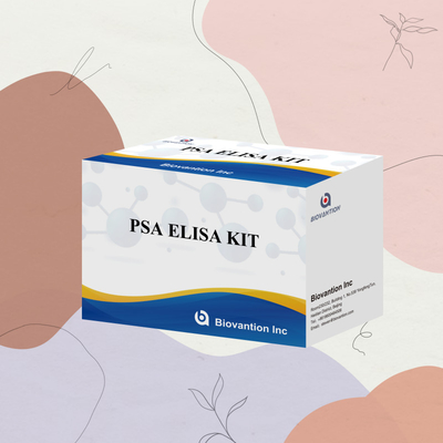 کیت آزمایش آنتی ژن خاص پروستات برای تشخیص حساس و خاص بیومارکرها در نمونه ها