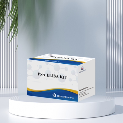 کیت آزمایش آنتی ژن خاص پروستات برای تشخیص حساس و خاص بیومارکرها در نمونه ها