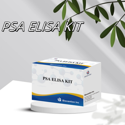 کیت تست پیشرفته PSA حساس به آنتی ژن خاص پروستات و تشخیص دقیق مواد هدف