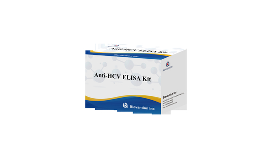 آنتی بادی های HCV را با کیت تست الیزای بیوانشن تشخیص دهید 96 آزمایش در 2-3 ساعت
