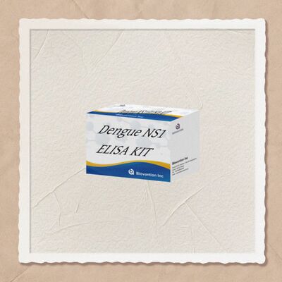 18 ماه مدت عودت کیت آزمایش IgM ELISA با حساسیت بالا و 96 آزمایش / کیت برای تشخیص آزمایشگاهی بیمارستان