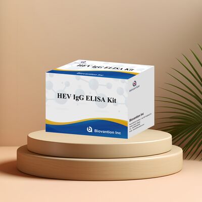 کیت آزمایش الایزا IgG-HEV با حساسیت بالا با اندازه 96T و 18 ماه ماندگاری برای تشخیص هپاتیت E