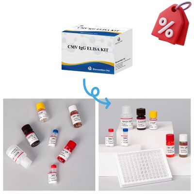 کیت آزمایش 96T CMV ELISA با تشخیص رنگ سنجی و روش ساندویچ برای آنتی بادی های سیتومگالوویروس