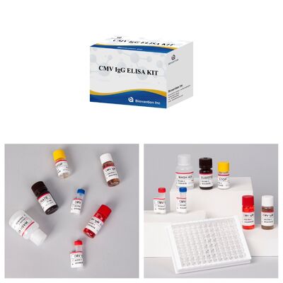 کیت آزمایش 96T CMV ELISA با تشخیص رنگ سنجی و روش ساندویچ برای آنتی بادی های سیتومگالوویروس