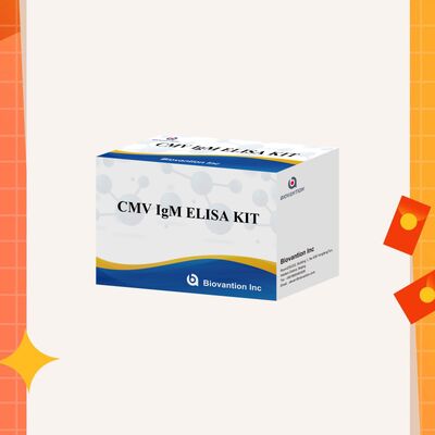 کیت آزمایش 96T CMV ELISA با تشخیص رنگ سنجی و روش ساندویچ برای آنتی بادی های سیتومگالوویروس