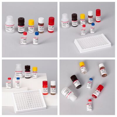 کیت آزمایش 96T CMV ELISA با تشخیص رنگ سنجی و روش ساندویچ برای آنتی بادی های سیتومگالوویروس