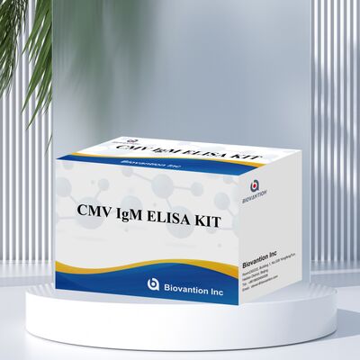 کیت آزمایش 96T CMV ELISA با تشخیص رنگ سنجی و روش ساندویچ برای آنتی بادی های سیتومگالوویروس
