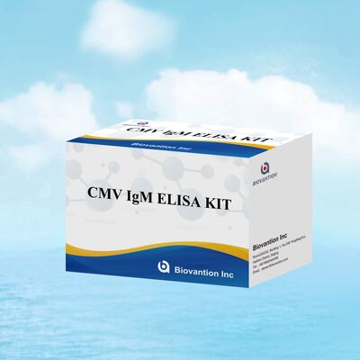 کیت آزمایش 96T CMV ELISA با تشخیص رنگ سنجی و روش ساندویچ برای آنتی بادی های سیتومگالوویروس