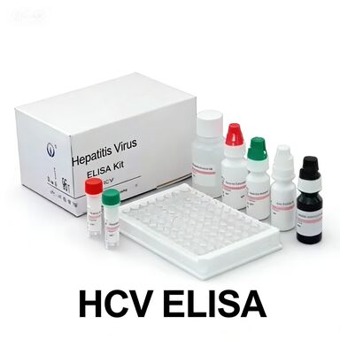 زمان انتقال آنتی بادی های ضد HCV به ویروس هپاتیت C به واسطه آنزیم کوتاه