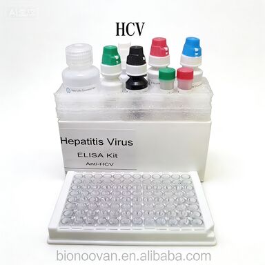 زمان انتقال آنتی بادی های ضد HCV به ویروس هپاتیت C به واسطه آنزیم کوتاه