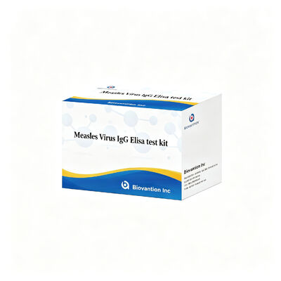 کیت آزمایش IgG ELISA ویروس سرخک حساسیت خاص بالا